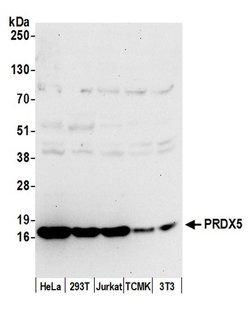 PRDX5 Polyclonal Antibody, Bethyl Laboratories 20 &mu;L; Unconjugated:Antibodies,