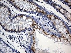 PRELID1 Monoclonal Antibody (OTI2A6), TrueMAB , OriGene:Antibodies:Primary
