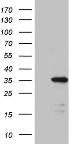 PRELID1 Monoclonal Antibody (OTI2B11), TrueMAB , OriGene 100 &mu;L; Unconjugated:Antibodies,