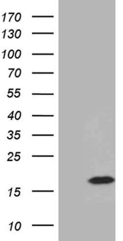 PRELID2 Monoclonal Antibody (OTI3B7), TrueMAB , OriGene:Antibodies:Primary
