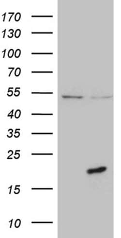 PRELID2 Monoclonal Antibody (OTI2F6), TrueMAB , OriGene:Antibodies:Primary