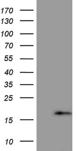 PRELID2 Mouse anti-Human, Clone: OTI6H6, lyophilized, TrueMAB 100 &mu;g;