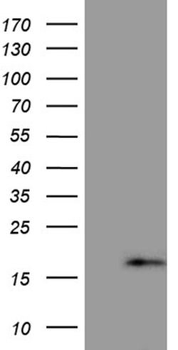 PRELID2 Monoclonal Antibody (OTI6H6), TrueMAB , OriGene:Antibodies:Primary