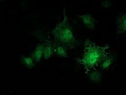 PRKAR1B Monoclonal Antibody (OTI2A3), TrueMAB , OriGene 100 &mu;L; Unconjugated:Antibodies,
