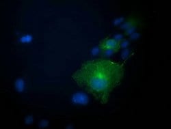 PRKAR1B Mouse anti-Human, Clone: OTI9C5, lyophilized, TrueMAB 100 &mu;g;