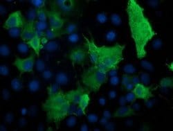 PRKAR1B Monoclonal Antibody (OTI12E5), TrueMAB , OriGene 100 &mu;L; Unconjugated:Antibodies,