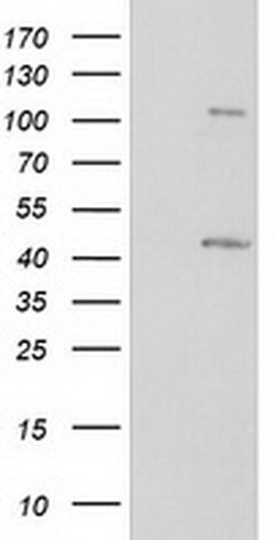 PRKAR1B Monoclonal Antibody (OTI2A3), TrueMAB , OriGene 100 &mu;L; Unconjugated:Antibodies,