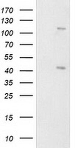 PRKAR1B Monoclonal Antibody (OTI9C5), TrueMAB , OriGene 30 &mu;L; Unconjugated:Antibodies,