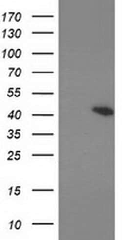 PRKAR1B Monoclonal Antibody (OTI12E5), TrueMAB , OriGene 100 &mu;L; Unconjugated:Antibodies,