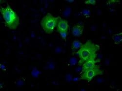 PRKAR2A Monoclonal Antibody (OTI1G7), TrueMAB , OriGene 100 &mu;L; Unconjugated:Antibodies,