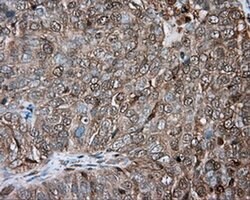 PRKAR2A Monoclonal Antibody (OTI1C4), TrueMAB , OriGene 30 &mu;L; Unconjugated:Antibodies,