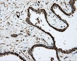 PRKAR2A Monoclonal Antibody (OTI1C4), TrueMAB , OriGene 30 &mu;L; Unconjugated:Antibodies,