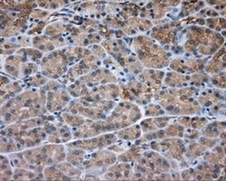 PRKAR2A Monoclonal Antibody (OTI1B4), TrueMAB , OriGene 100 &mu;L; Unconjugated:Antibodies,