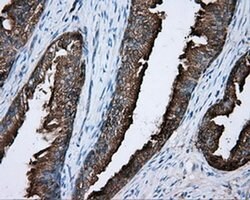 PRKAR2A Monoclonal Antibody (OTI1B4), TrueMAB , OriGene 100 &mu;L; Unconjugated:Antibodies,