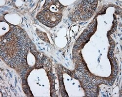PRKAR2A Monoclonal Antibody (OTI1B4), TrueMAB , OriGene 100 &mu;L; Unconjugated:Antibodies,