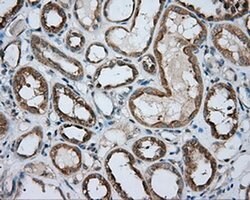 PRKAR2A Monoclonal Antibody (OTI1B4), TrueMAB , OriGene 100 &mu;L; Unconjugated:Antibodies,