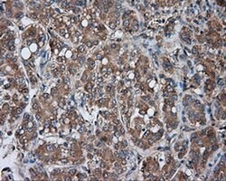 PRKAR2A Monoclonal Antibody (OTI1B4), TrueMAB , OriGene 100 &mu;L; Unconjugated:Antibodies,