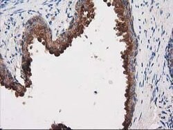 PRKAR2A Mouse anti-Human, Clone: OTI1F8, lyophilized, TrueMAB 100 &mu;g;