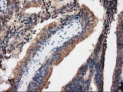 PRKAR2A Mouse anti-Human, Clone: OTI1F8, liquid, TrueMAB 30 &mu;L; Unconjugated:Antibodies,