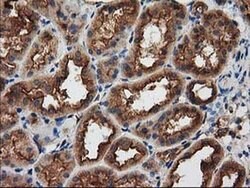 PRKAR2A Mouse anti-Human, Clone: OTI1F8, liquid, TrueMAB 30 &mu;L; Unconjugated:Antibodies,