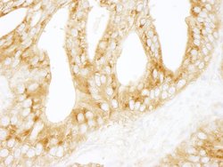 PRKAR2A/PKA-RIIalpha Polyclonal Antibody, Bethyl Laboratories 10 &mu;L;
