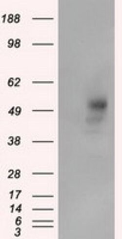 PRKAR2A Mouse anti-Human, Clone: OTI1G7, lyophilized, TrueMAB 100 &mu;g | Buy Online | Origene Technologies | Fisher Scientific