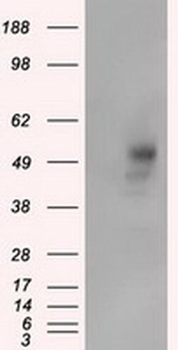 PRKAR2A Monoclonal Antibody (OTI1G7), TrueMAB , OriGene 100 &mu;L; Unconjugated:Antibodies,
