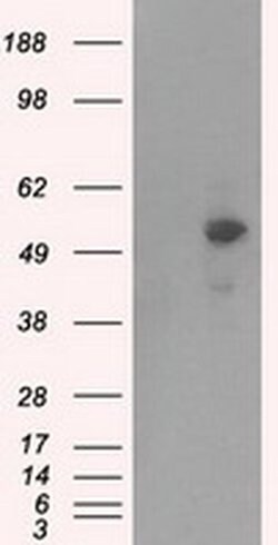 PRKAR2A Monoclonal Antibody (OTI1C4), TrueMAB , OriGene 30 &mu;L; Unconjugated:Antibodies,