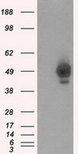 PRKAR2A Monoclonal Antibody (OTI1B4), TrueMAB , OriGene 100 &mu;L; Unconjugated:Antibodies,