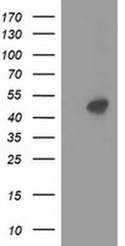 PRKAR2A Mouse anti-Human, Clone: OTI1F8, liquid, TrueMAB 30 &mu;L; Unconjugated:Antibodies,