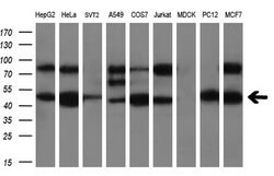 PRKAR2A Mouse anti-Human, Clone: OTI1F8, liquid, TrueMAB 30 &mu;L; Unconjugated:Antibodies,
