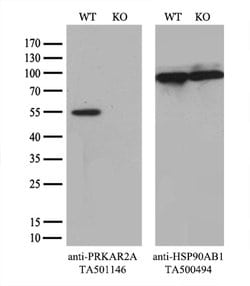 PRKAR2A Mouse anti-Human, Clone: OTI1F8, lyophilized, TrueMAB 100 &mu;g;