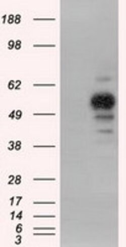 PRKAR2A Mouse anti-Canine, Human, Rat, Clone: OTI5F1, lyophilized, TrueMAB