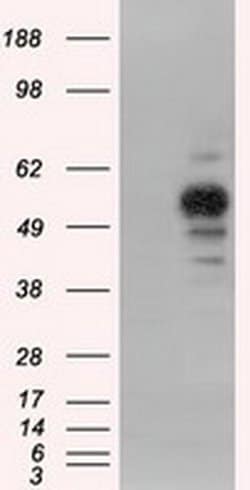 PRKAR2A Mouse anti-Canine, Human, Rat, Clone: OTI5F1, liquid, TrueMAB 100