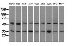 PRKAR2A Mouse anti-Canine, Human, Rat, Clone: OTI5F1, liquid, TrueMAB 100