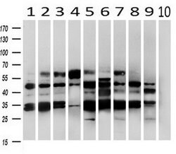 PRKAR2A Mouse anti-Canine, Human, Rat, Clone: OTI5F1, lyophilized, TrueMAB