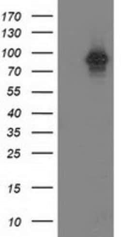 PRKCE Mouse anti-Canine, Human, Clone: OTI2E9, lyophilized, TrueMAB 100
