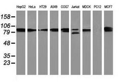 PRKCE Mouse anti-Canine, Human, Clone: OTI2E9, lyophilized, TrueMAB 100