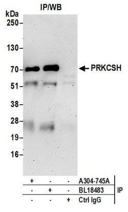 PRKCSH Rabbit anti-Human, Mouse, Polyclonal, Bethyl Laboratories 100 &mu;l;