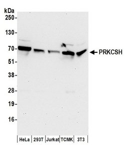 PRKCSH Polyclonal Antibody, Bethyl Laboratories 20 &mu;L; Unconjugated:Antibodies,