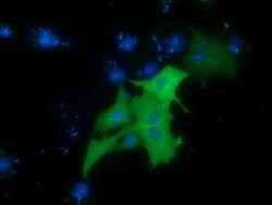 PRKD2 Monoclonal Antibody (OTI2E2), TrueMAB , OriGene:Antibodies:Primary