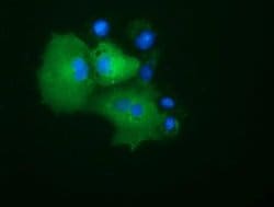 PRKD2 Monoclonal Antibody (OTI5A3), TrueMAB , OriGene 30 &mu;L; Unconjugated:Antibodies,
