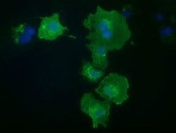 PRKD2 Monoclonal Antibody (OTI3B12), TrueMAB , OriGene 30 &mu;L; Unconjugated:Antibodies,