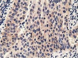 PRKD2 Monoclonal Antibody (OTI5A3), TrueMAB , OriGene 30 &mu;L; Unconjugated:Antibodies,