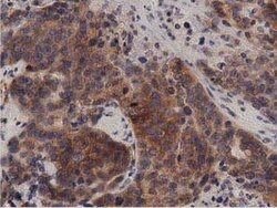 PRKD2 Mouse anti-Canine, Human, Rat, Clone: OTI5G1, lyophilized, TrueMAB
