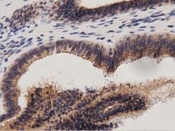 PRKD2 Mouse anti-Canine, Human, Rat, Clone: OTI5G1, lyophilized, TrueMAB