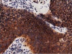 PRKD2 Mouse anti-Canine, Human, Rat, Clone: OTI5G1, lyophilized, TrueMAB