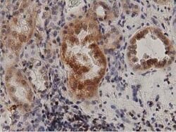 PRKD2 Mouse anti-Canine, Human, Rat, Clone: OTI5G1, lyophilized, TrueMAB