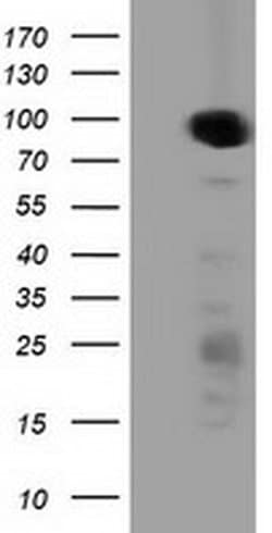 PRKD2 Monoclonal Antibody (OTI5A3), TrueMAB , OriGene 30 &mu;L; Unconjugated:Antibodies,