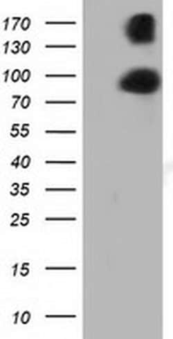 PRKD2 Monoclonal Antibody (OTI3A1), TrueMAB , OriGene 30 &mu;L; Unconjugated:Antibodies,